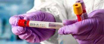 На Дніпропетровщині від COVID-19 одужали ще 1445 мешканців