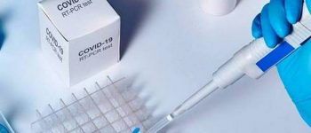Оперативна інформація щодо поширення коронавірусної інфекції COVID -19 на Дніпропетровщині на 04 серпня